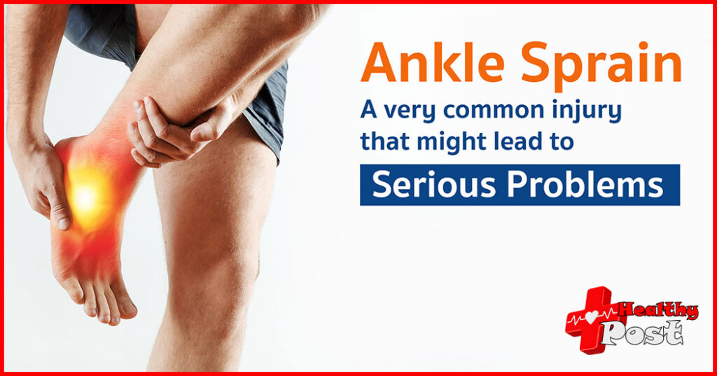 Ankle Sprain