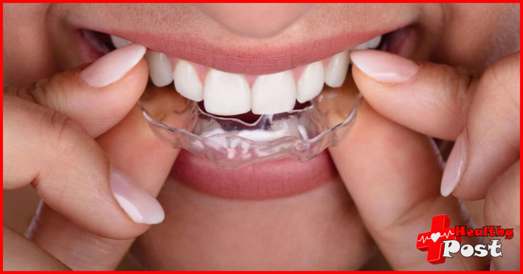Toothsi