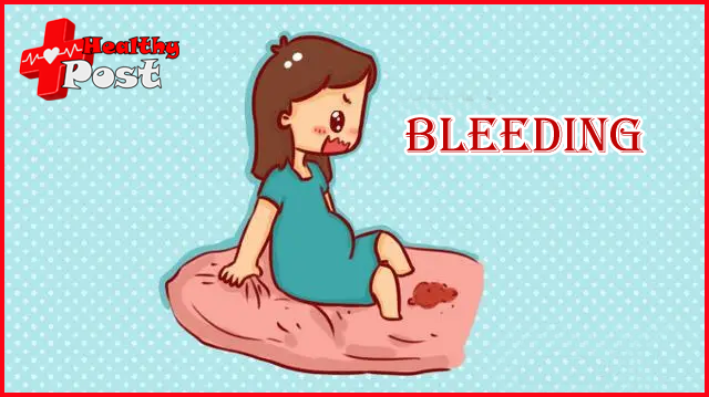 Bleeding in pregnancy symptoms