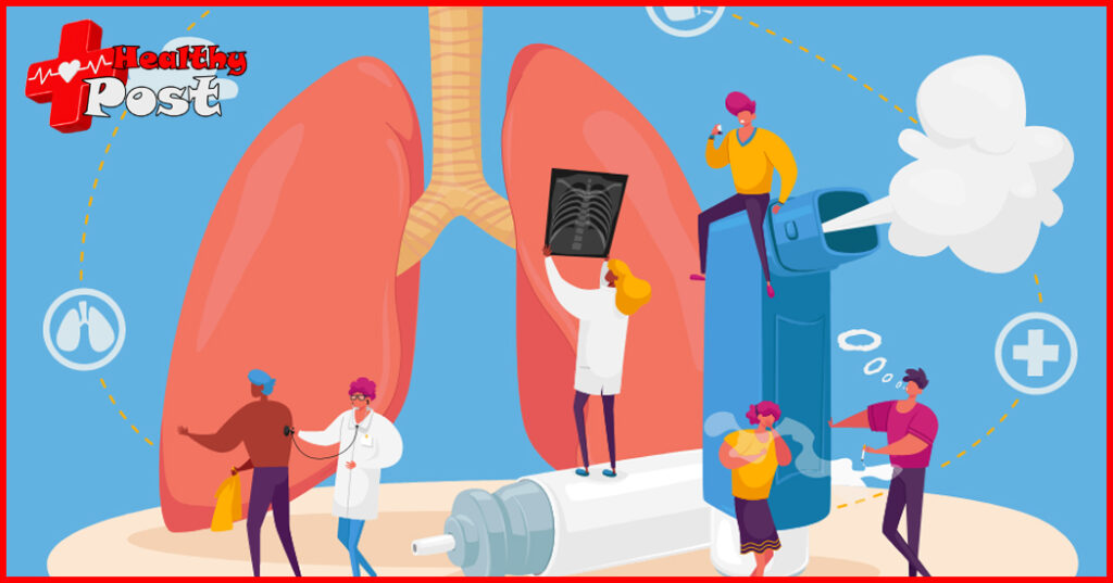 Eosinophilic asthma
