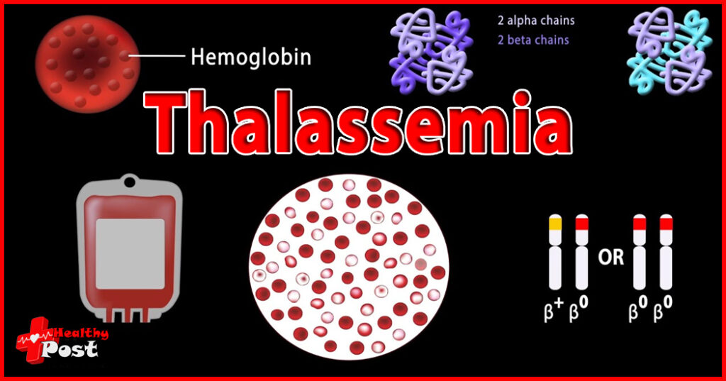 Thalassemia