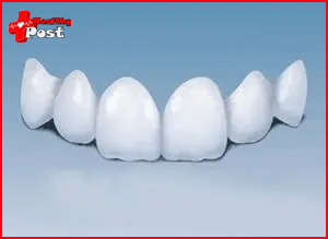 disadvantages of dental crowns