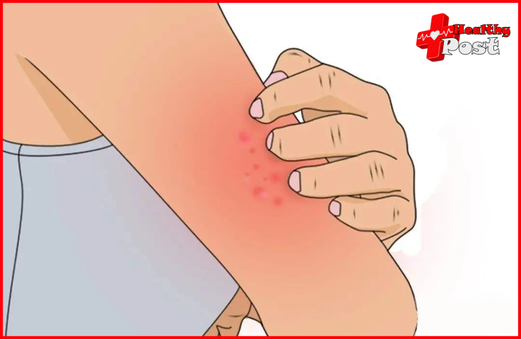 Skin ulcer