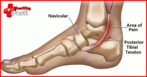 inner ankle pain