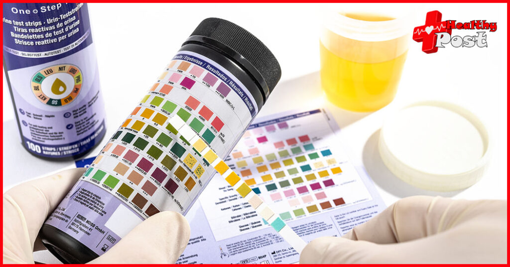 urine test strips