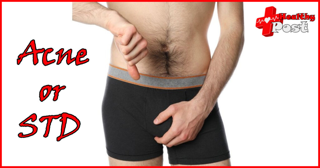 Pimples on penis, is penis acne or an STD? identification guide Acne or STD