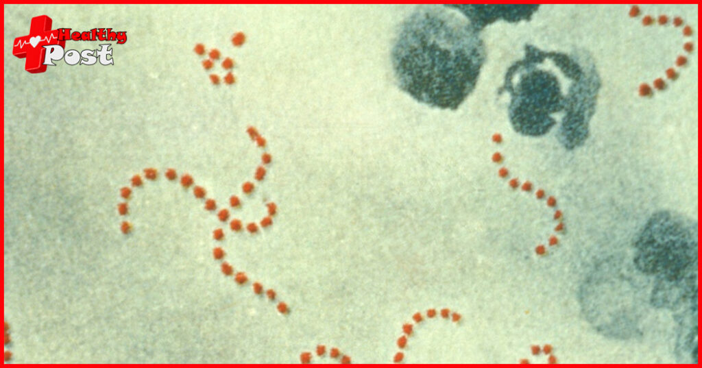 Cocci