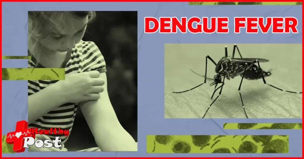 If you have a fever, how do you know if I have dengue fever? DENGUE FEVER