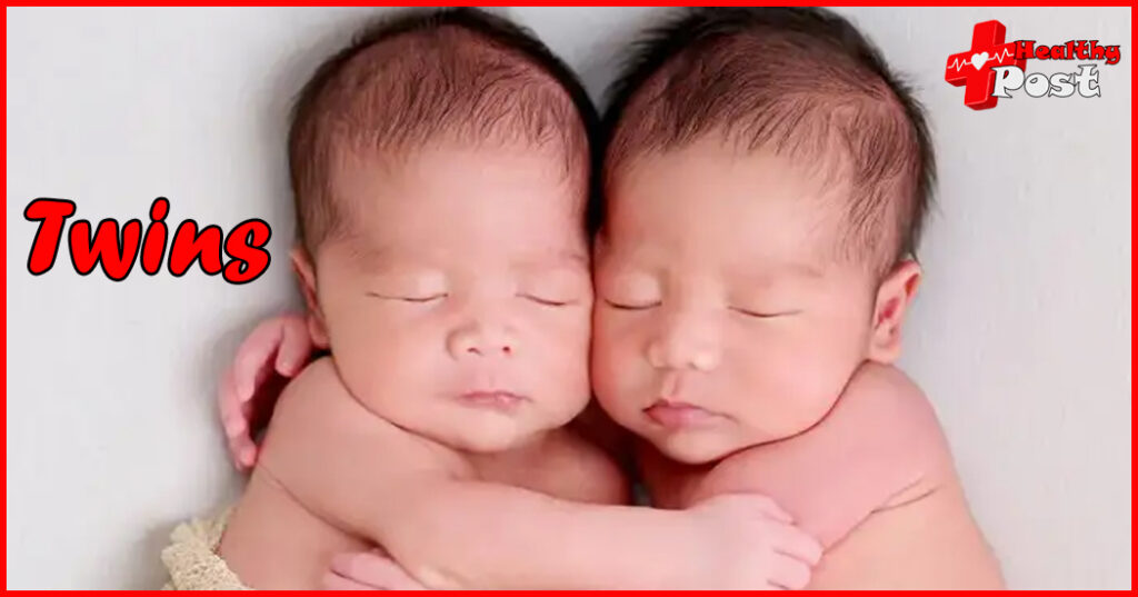 How Twins are formed, it turns out there are so many secrets! Twins