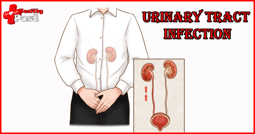 Urinary tract infection