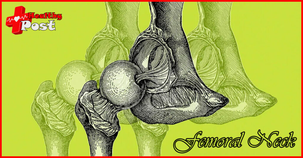femoral neck