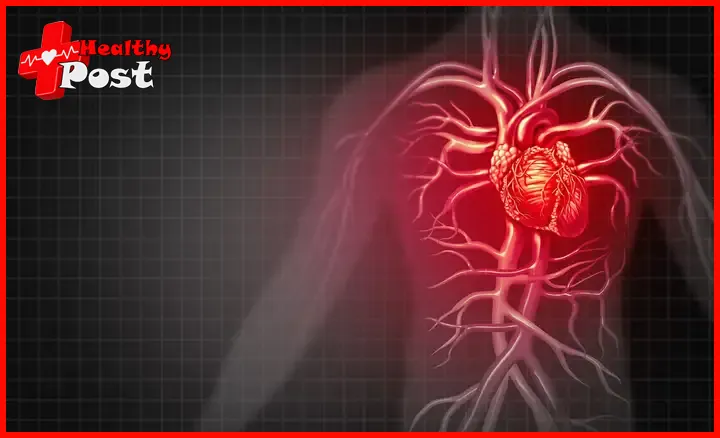 Cardiovascular Disease