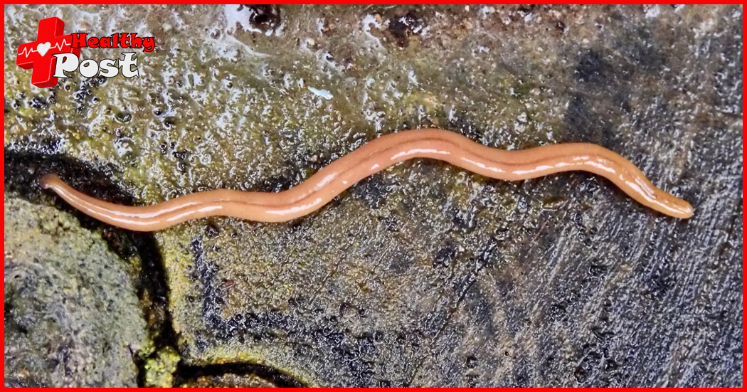 invasive hammerhead worms