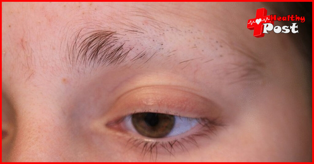Eyebrows