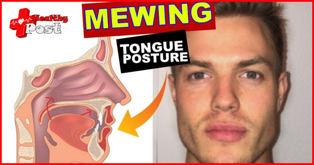 Mewing