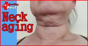 Neck aging