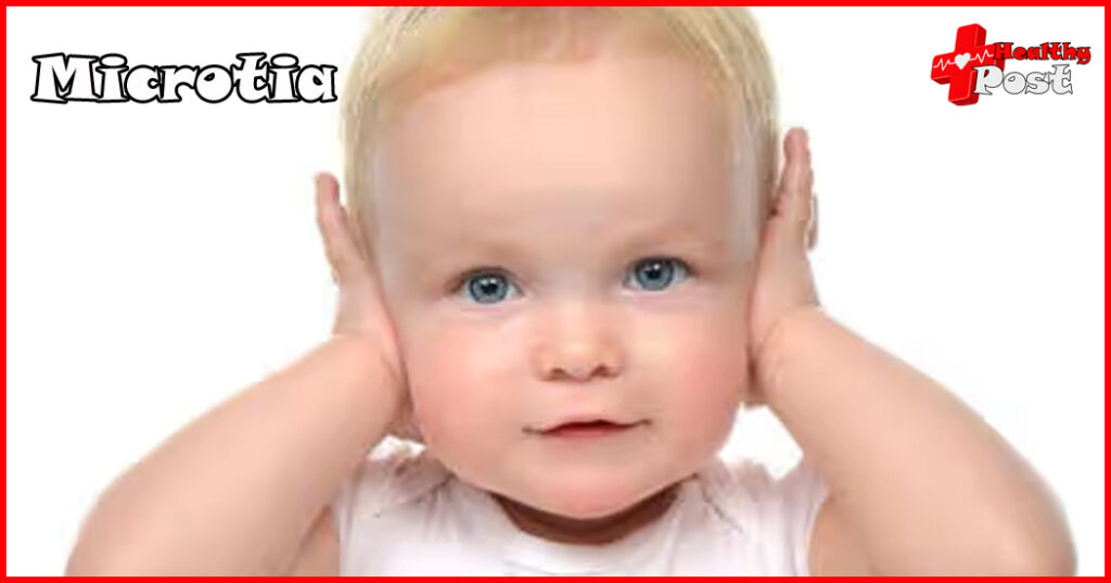 microtia