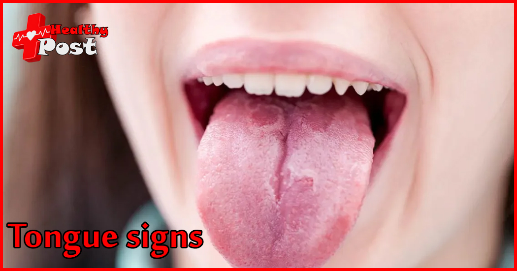 tongue signs