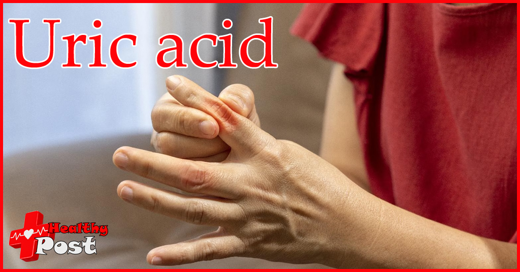 Uric Acid