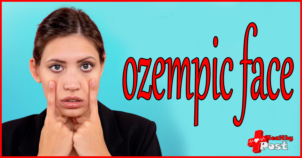 ozempic face