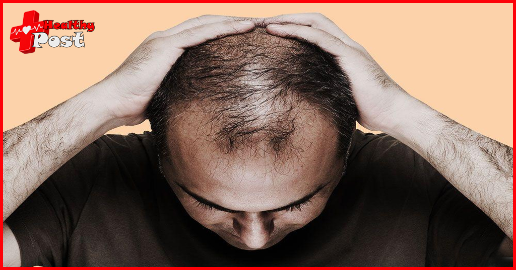 Does creatine cause hair loss