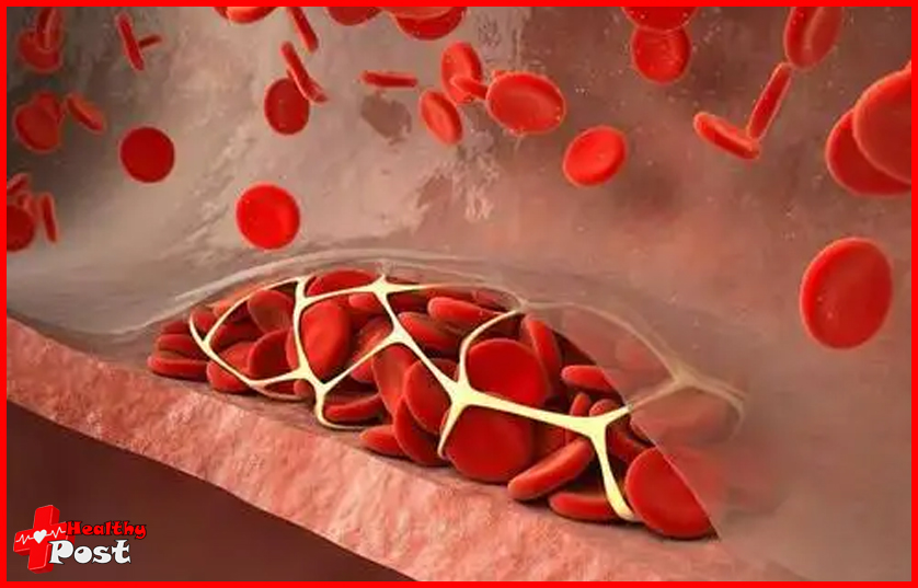 Triglyceride Levels