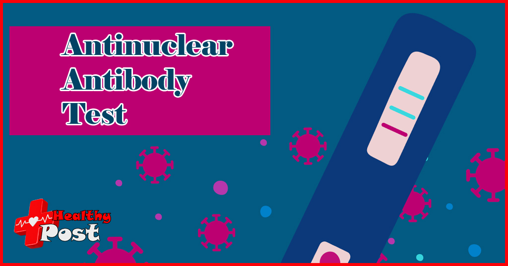 antinuclear antibody test