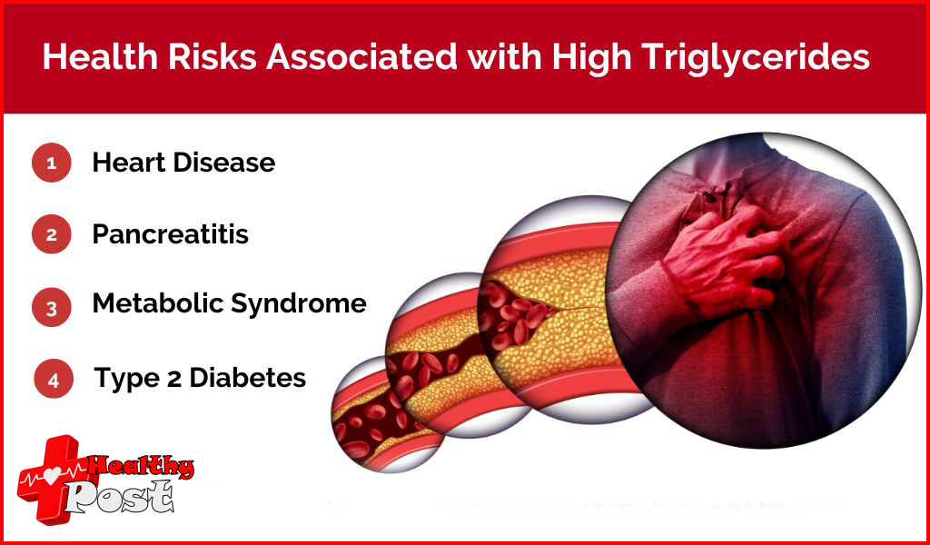 Triglyceride Levels