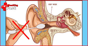 Ear Wax Removal Kit