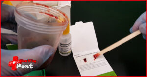 Fecal occult blood test