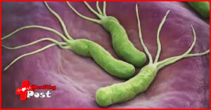 Helicobacter pylori