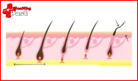 minoxidil beard Process