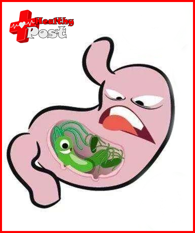 Helicobacter pylori