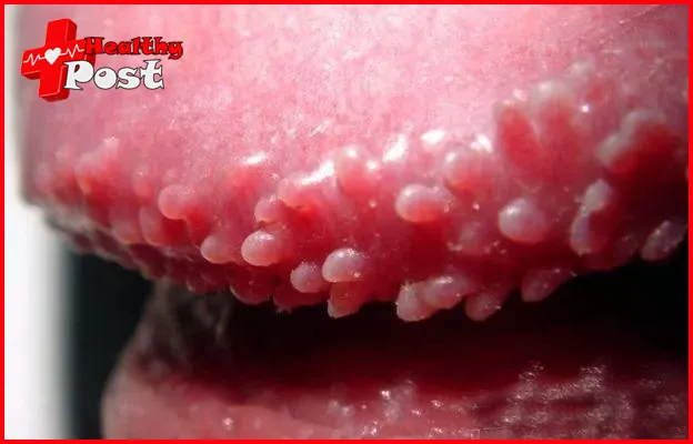 69 Pose and Oral Sex: STI Risks, Health Risks & Safer Practices 4 69 pose and oral sex risk