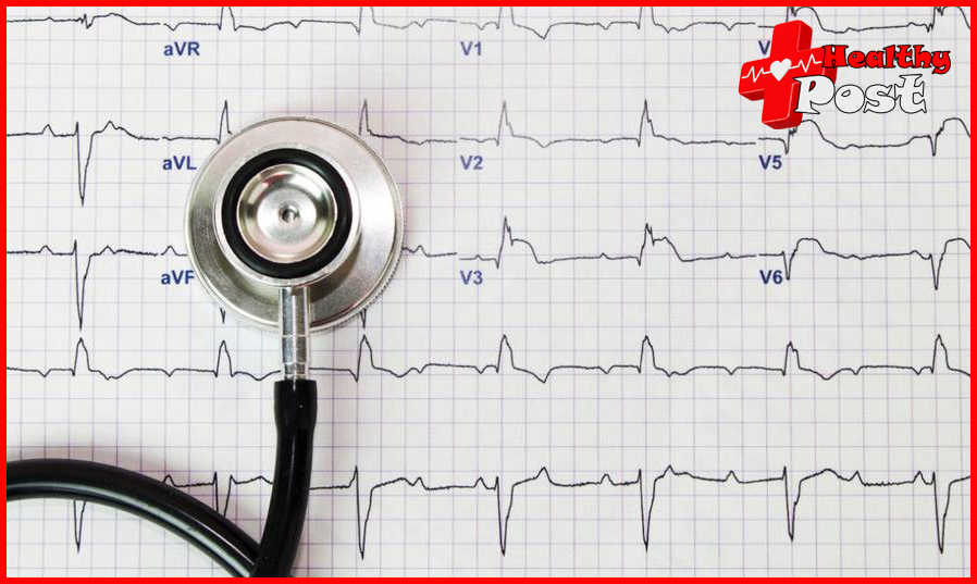 Atrial Fibrillation