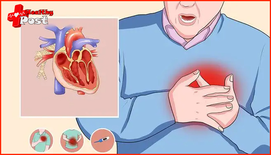 myocardial ischemia