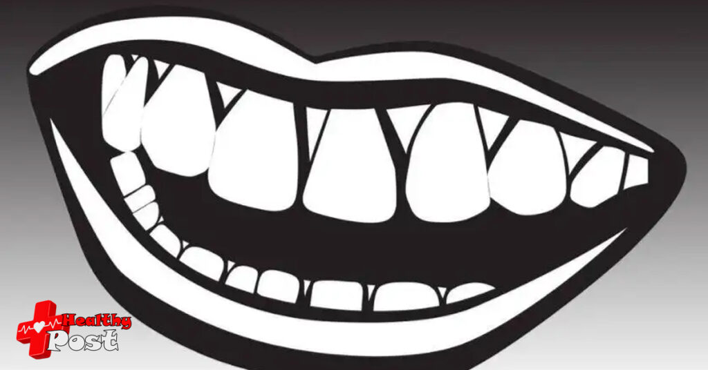 Bad Teeth
