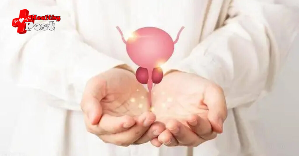Erectile Dysfunction and Treatment After Radical Prostatectomy Radical prostatectomy