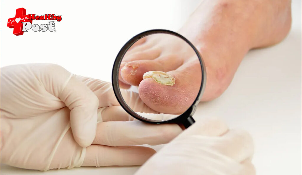 Nail disease in children: early manifestations and diagnostic recommendations Nails disease