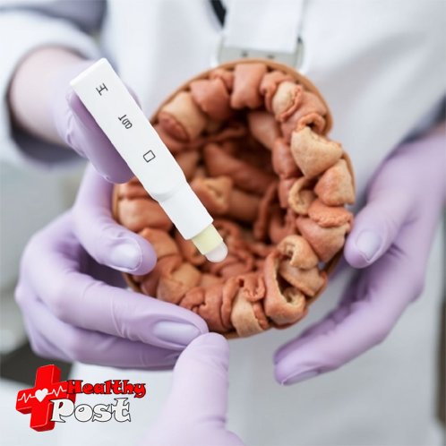 lactoferrin stool test
