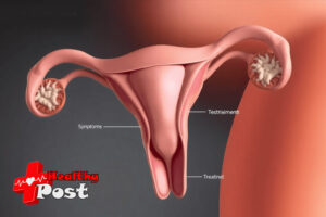 septate hymen