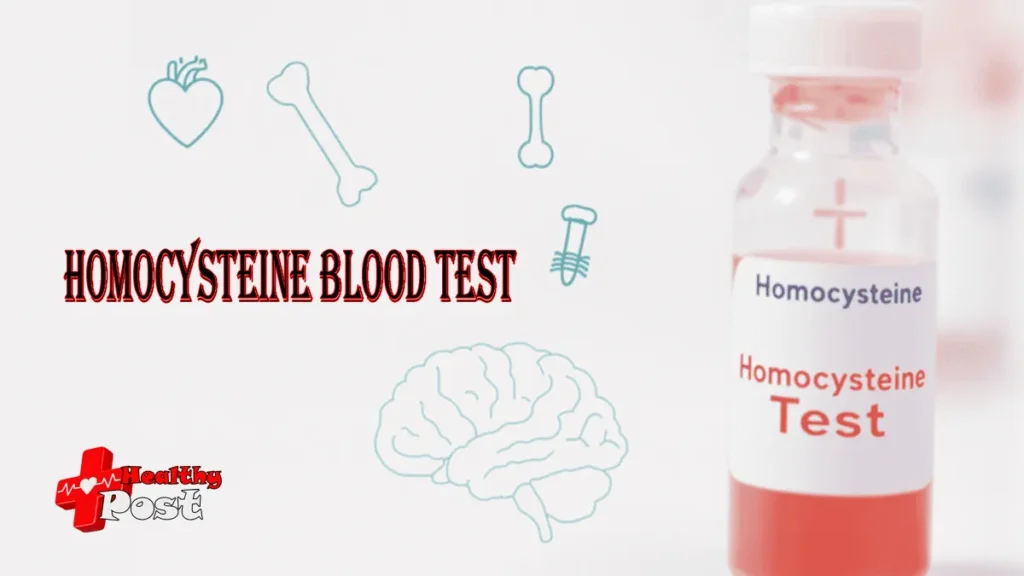 3 Dangerous Health Risks a Homocysteine Blood Test Can Detect Early homocysteine blood test