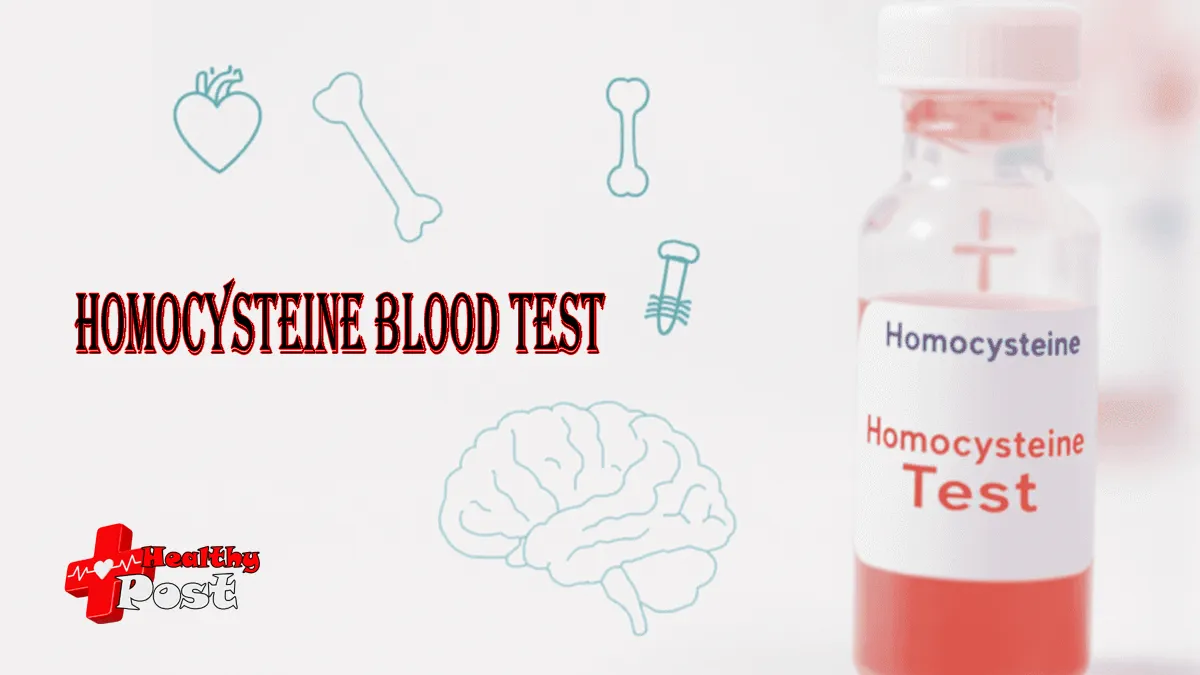 homocysteine blood test