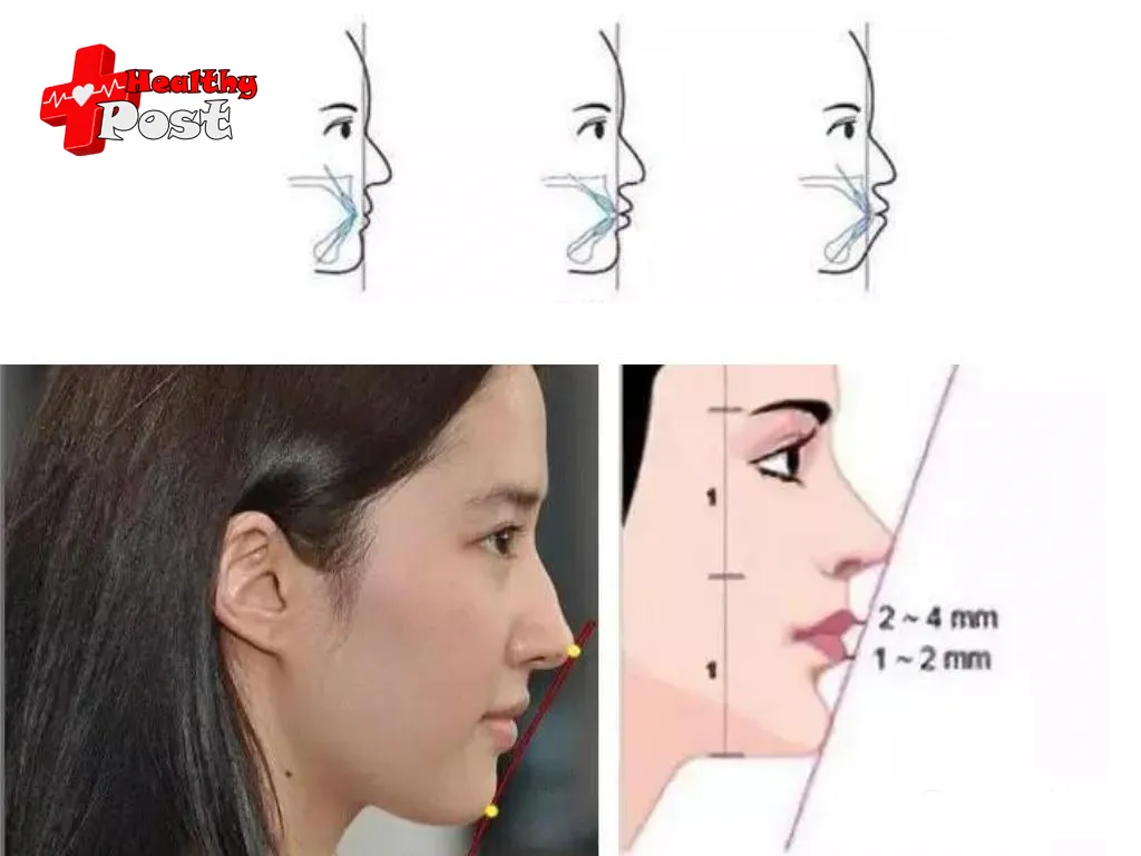 Orthodontic Treatment