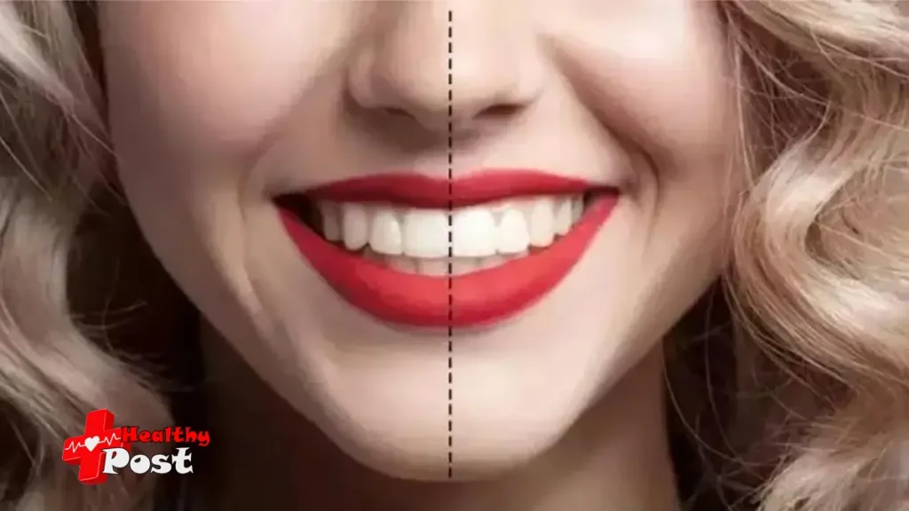 A professional dental clinic desktop displaying a 3D digital model of a misaligned bite next to clear aligners to explain the functional reasons for orthodontic treatment.
