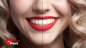 Orthodontic Treatment