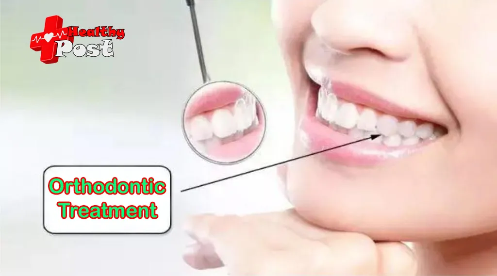 Orthodontic Treatment