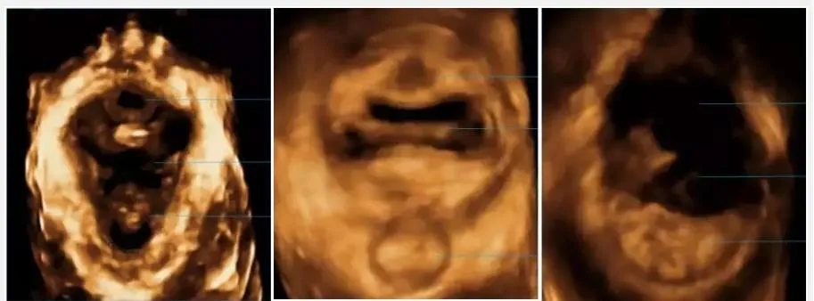 pelvic ultrasound