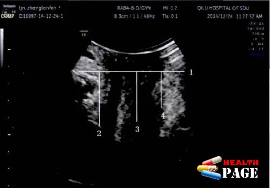 pelvic ultrasound