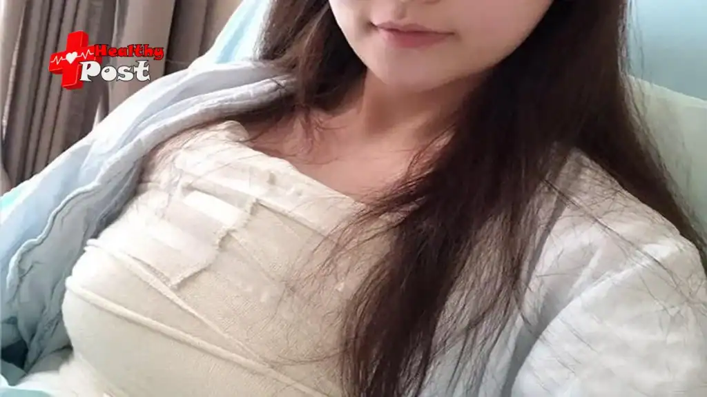 breast plastic surgery